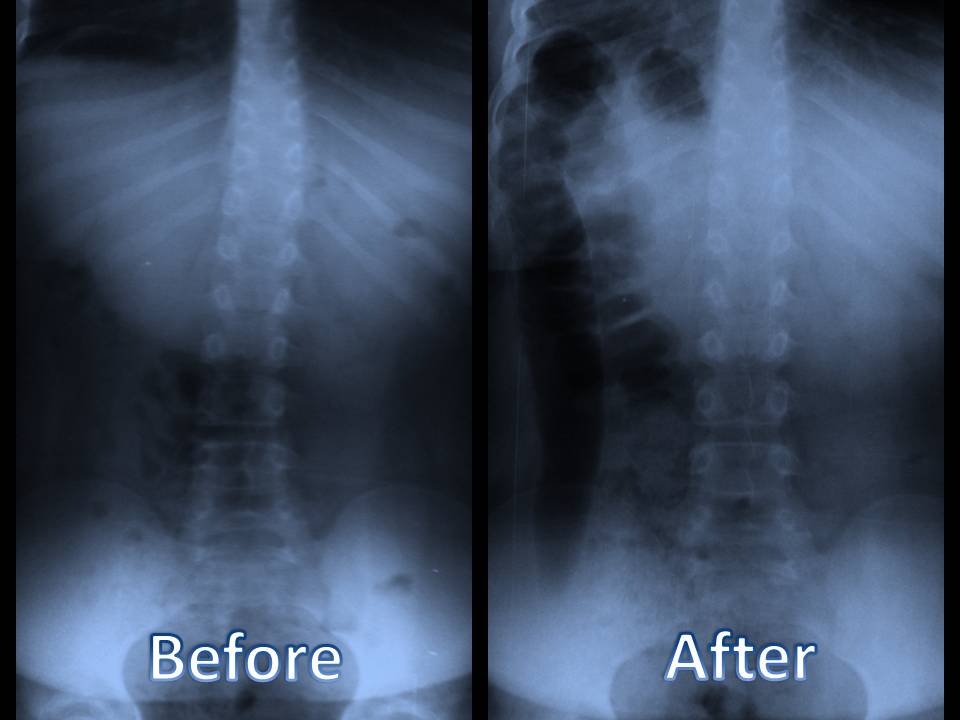 what is chiropractic therapy